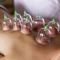 cupping massage