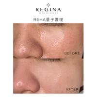 藻針  清粉刺  美容煥膚  肌膚健康養成  透白  零毛孔  痘痘剋星  坑洞救星  痘疤淡化 幹細胞科技  維珍娜藻針  安平做臉  台南清粉刺  台南做臉  無痛清粉刺  台南美容 台南做臉推薦  臉部雕塑  台南清痘痘  婚前保養