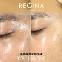 藻針  清粉刺  美容煥膚  肌膚健康養成  透白  零毛孔  痘痘剋星  坑洞救星  痘疤淡化 幹細胞科技  維珍娜藻針  安平做臉  台南清粉刺  台南做臉  無痛清粉刺  台南美容 台南做臉推薦  臉部雕塑  台南清痘痘  婚前保養