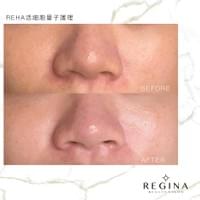 藻針  清粉刺  美容煥膚  肌膚健康養成  透白  零毛孔  痘痘剋星  坑洞救星  痘疤淡化 幹細胞科技  維珍娜藻針  安平做臉  台南清粉刺  台南做臉  無痛清粉刺  台南美容 台南做臉推薦  臉部雕塑  台南清痘痘  婚前保養