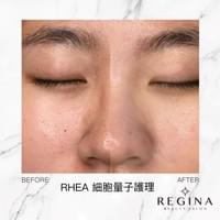 藻針  清粉刺  美容煥膚  肌膚健康養成  透白  零毛孔  痘痘剋星  坑洞救星  痘疤淡化 幹細胞科技  維珍娜藻針  安平做臉  台南清粉刺  台南做臉  無痛清粉刺  台南美容 台南做臉推薦  臉部雕塑  台南清痘痘  婚前保養