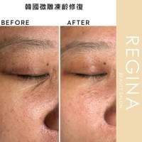 藻針  清粉刺  美容煥膚  肌膚健康養成  透白  零毛孔  痘痘剋星  坑洞救星  痘疤淡化 幹細胞科技  維珍娜藻針  安平做臉  台南清粉刺  台南做臉  無痛清粉刺  台南美容 台南做臉推薦  臉部雕塑  台南清痘痘  婚前保養