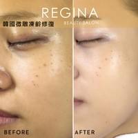 藻針  清粉刺  美容煥膚  肌膚健康養成  透白  零毛孔  痘痘剋星  坑洞救星  痘疤淡化 幹細胞科技  維珍娜藻針  安平做臉  台南清粉刺  台南做臉  無痛清粉刺  台南美容 台南做臉推薦  臉部雕塑  台南清痘痘  婚前保養