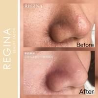 藻針  清粉刺  美容煥膚  肌膚健康養成  透白  零毛孔  痘痘剋星  坑洞救星  痘疤淡化 幹細胞科技  維珍娜藻針  安平做臉  台南清粉刺  台南做臉  無痛清粉刺  台南美容 台南做臉推薦  臉部雕塑  台南清痘痘  婚前保養