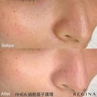 藻針  清粉刺  美容煥膚  肌膚健康養成  透白  零毛孔  痘痘剋星  坑洞救星  痘疤淡化 幹細胞科技  維珍娜藻針  安平做臉  台南清粉刺  台南做臉  無痛清粉刺  台南美容 台南做臉推薦  臉部雕塑  台南清痘痘  婚前保養