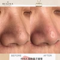 藻針  清粉刺  美容煥膚  肌膚健康養成  透白  零毛孔  痘痘剋星  坑洞救星  痘疤淡化 幹細胞科技  維珍娜藻針  安平做臉  台南清粉刺  台南做臉  無痛清粉刺  台南美容 台南做臉推薦  臉部雕塑  台南清痘痘  婚前保養