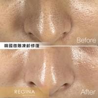 藻針  清粉刺  美容煥膚  肌膚健康養成  透白  零毛孔  痘痘剋星  坑洞救星  痘疤淡化 幹細胞科技  維珍娜藻針  安平做臉  台南清粉刺  台南做臉  無痛清粉刺  台南美容 台南做臉推薦  臉部雕塑  台南清痘痘  婚前保養