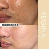 藻針  清粉刺  美容煥膚  肌膚健康養成  透白  零毛孔  痘痘剋星  坑洞救星  痘疤淡化 幹細胞科技  維珍娜藻針  安平做臉  台南清粉刺  台南做臉  無痛清粉刺  台南美容 台南做臉推薦  臉部雕塑  台南清痘痘  婚前保養