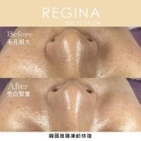 藻針  清粉刺  美容煥膚  肌膚健康養成  透白  零毛孔  痘痘剋星  坑洞救星  痘疤淡化 幹細胞科技  維珍娜藻針  安平做臉  台南清粉刺  台南做臉  無痛清粉刺  台南美容 台南做臉推薦  臉部雕塑  台南清痘痘  婚前保養