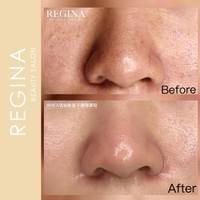 藻針  清粉刺  美容煥膚  肌膚健康養成  透白  零毛孔  痘痘剋星  坑洞救星  痘疤淡化 幹細胞科技  維珍娜藻針  安平做臉  台南清粉刺  台南做臉  無痛清粉刺  台南美容 台南做臉推薦  臉部雕塑  台南清痘痘  婚前保養