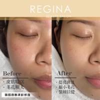 藻針  清粉刺  美容煥膚  肌膚健康養成  透白  零毛孔  痘痘剋星  坑洞救星  痘疤淡化 幹細胞科技  維珍娜藻針  安平做臉  台南清粉刺  台南做臉  無痛清粉刺  台南美容 台南做臉推薦  臉部雕塑  台南清痘痘  婚前保養