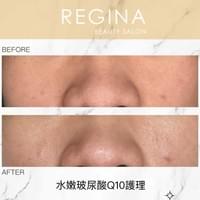 藻針  清粉刺  美容煥膚  肌膚健康養成  透白  零毛孔  痘痘剋星  坑洞救星  痘疤淡化 幹細胞科技  維珍娜藻針  安平做臉  台南清粉刺  台南做臉  無痛清粉刺  台南美容 台南做臉推薦  臉部雕塑  台南清痘痘  婚前保養