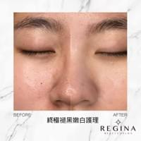 藻針  清粉刺  美容煥膚  肌膚健康養成  透白  零毛孔  痘痘剋星  坑洞救星  痘疤淡化 幹細胞科技  維珍娜藻針  安平做臉  台南清粉刺  台南做臉  無痛清粉刺  台南美容 台南做臉推薦  臉部雕塑  台南清痘痘  婚前保養