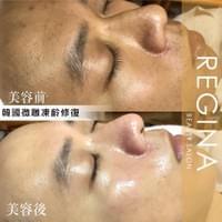 藻針  清粉刺  美容煥膚  肌膚健康養成  透白  零毛孔  痘痘剋星  坑洞救星  痘疤淡化 幹細胞科技  維珍娜藻針  安平做臉  台南清粉刺  台南做臉  無痛清粉刺  台南美容 台南做臉推薦  臉部雕塑  台南清痘痘  婚前保養