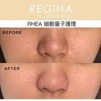 藻針  清粉刺  美容煥膚  肌膚健康養成  透白  零毛孔  痘痘剋星  坑洞救星  痘疤淡化 幹細胞科技  維珍娜藻針  安平做臉  台南清粉刺  台南做臉  無痛清粉刺  台南美容 台南做臉推薦  臉部雕塑  台南清痘痘  婚前保養