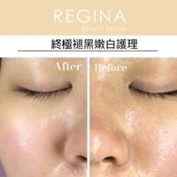 藻針  清粉刺  美容煥膚  肌膚健康養成  透白  零毛孔  痘痘剋星  坑洞救星  痘疤淡化 幹細胞科技  維珍娜藻針  安平做臉  台南清粉刺  台南做臉  無痛清粉刺  台南美容 台南做臉推薦  臉部雕塑  台南清痘痘  婚前保養