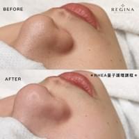 藻針  清粉刺  美容煥膚  肌膚健康養成  透白  零毛孔  痘痘剋星  坑洞救星  痘疤淡化 幹細胞科技  維珍娜藻針  安平做臉  台南清粉刺  台南做臉  無痛清粉刺  台南美容 台南做臉推薦  臉部雕塑  台南清痘痘  婚前保養