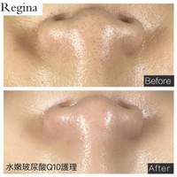 藻針  清粉刺  美容煥膚  肌膚健康養成  透白  零毛孔  痘痘剋星  坑洞救星  痘疤淡化 幹細胞科技  維珍娜藻針  安平做臉  台南清粉刺  台南做臉  無痛清粉刺  台南美容 台南做臉推薦  臉部雕塑  台南清痘痘  婚前保養