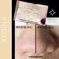 藻針  清粉刺  美容煥膚  肌膚健康養成  透白  零毛孔  痘痘剋星  坑洞救星  痘疤淡化 幹細胞科技  維珍娜藻針  安平做臉  台南清粉刺  台南做臉  無痛清粉刺  台南美容 台南做臉推薦  臉部雕塑  台南清痘痘  婚前保養