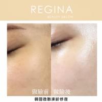 藻針  清粉刺  美容煥膚  肌膚健康養成  透白  零毛孔  痘痘剋星  坑洞救星  痘疤淡化 幹細胞科技  維珍娜藻針  安平做臉  台南清粉刺  台南做臉  無痛清粉刺  台南美容 台南做臉推薦  臉部雕塑  台南清痘痘  婚前保養