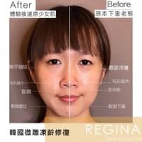 藻針  清粉刺  美容煥膚  肌膚健康養成  透白  零毛孔  痘痘剋星  坑洞救星  痘疤淡化 幹細胞科技  維珍娜藻針  安平做臉  台南清粉刺  台南做臉  無痛清粉刺  台南美容 台南做臉推薦  臉部雕塑  台南清痘痘  婚前保養