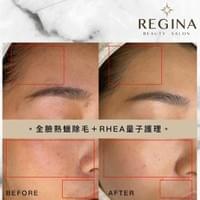 藻針  清粉刺  美容煥膚  肌膚健康養成  透白  零毛孔  痘痘剋星  坑洞救星  痘疤淡化 幹細胞科技  維珍娜藻針  安平做臉  台南清粉刺  台南做臉  無痛清粉刺  台南美容 台南做臉推薦  臉部雕塑  台南清痘痘  婚前保養