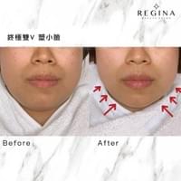 藻針  清粉刺  美容煥膚  肌膚健康養成  透白  零毛孔  痘痘剋星  坑洞救星  痘疤淡化 幹細胞科技  維珍娜藻針  安平做臉  台南清粉刺  台南做臉  無痛清粉刺  台南美容 台南做臉推薦  臉部雕塑  台南清痘痘  婚前保養