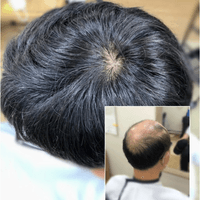補髮片自然髮旋與灰白髮絲