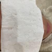 #莯洸美學 #矽幻膚 #清粉刺 #藻針 #美背 #緊緻V臉