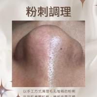 #莯洸美學 美容區 粉刺調理