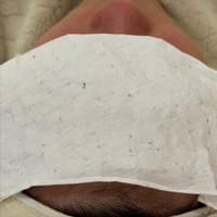 #莯洸美學 #矽幻膚 #清粉刺 #藻針 #美背 #緊緻V臉