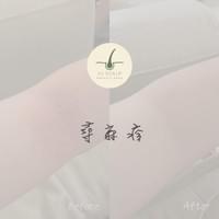 #新店sig頭皮健髮專家 #台中JuScalp頭皮養護中心