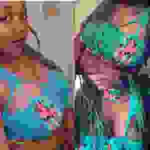 broken image