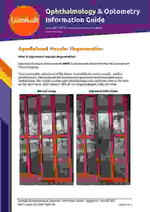 Age-Related Macular Degeneration: Ophthalmology & Optometry Information Guide (Digital Download)