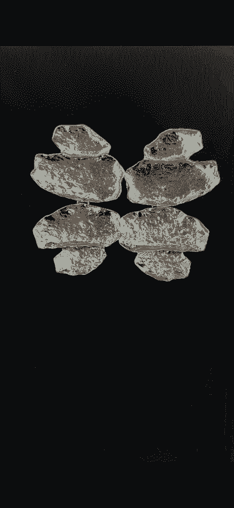 ARETES METALICOS