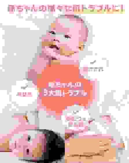 【日本直送】池田模範堂 Muhi無比滴BABY 蚊蟲叮咬止癢軟膏 出生1個月後適用 15g 大阪實體藥妝店直送