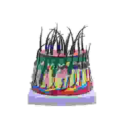 Pathology Enlarged Scalp Structure Model Human Anatomic Medical Teaching Tool Learning Display Aid