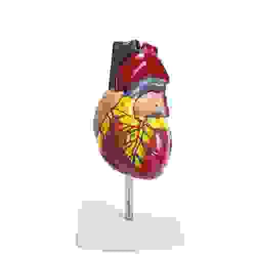 Pathology Cardiac Model Human Anatomic Medical Physiological Anatomy Teaching Learning Display Aid