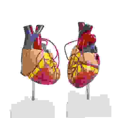 Heart Bypass Model Human Anatomic Medical Model Anatomical Teaching Tool Learning Display Aid