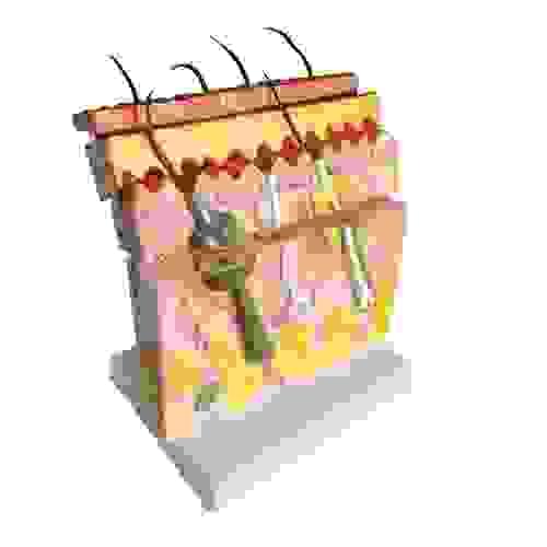 Pathology 70X Sectional Skin Model Human Anatomic Medical Anatomical Teaching Learning Display Aid