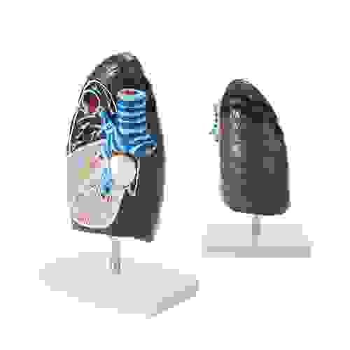 Pathological Lung Model Human Anatomic Medical Model Anatomical Teaching Learning Display Aid