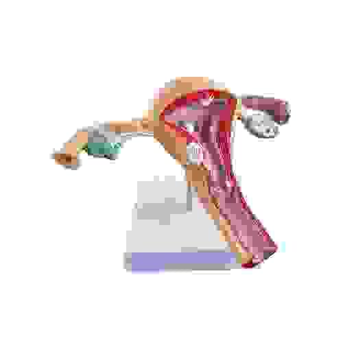 Pathological Uterus Model Human Anatomic Medical Model Anatomical Teaching Tool Learning Display Aid