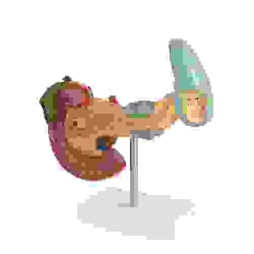 Pathological Spleen Model Human Anatomic Medical Model Anatomical Teaching Tool Learning Display Aid