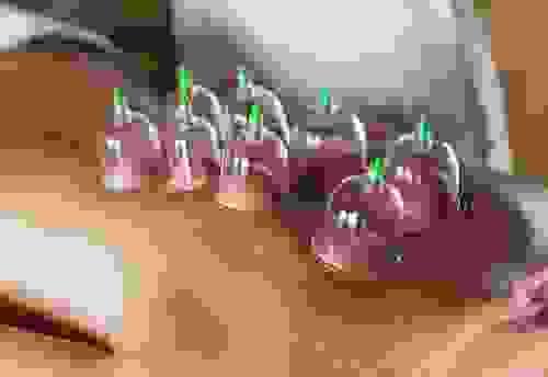 Cupping Therapy (Please text to 323-416-9092 to make appointment)