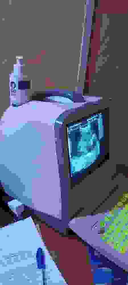 Weekly Ultrasound (ultra scan)