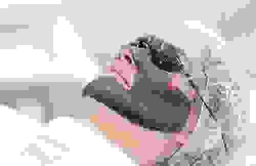 Carbon Laser Peel 黑脸娃娃