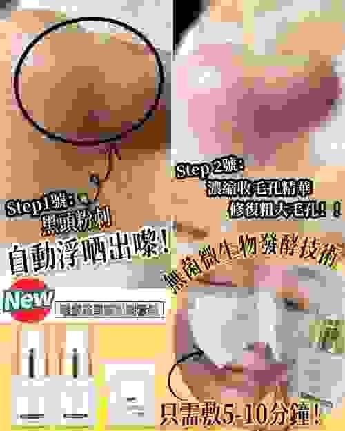  Bohaty 「理療祛黑頭粉刺套」套裝包括：黑頭溶解黑頭粉刺精華 𝐱 一支 +濃縮收毛孔精華x一支