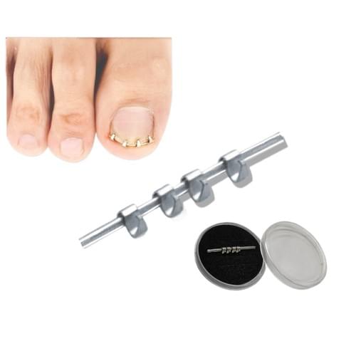 Ingrown Toenail Corrector Toe Nail Brace for Curved Toe Nail