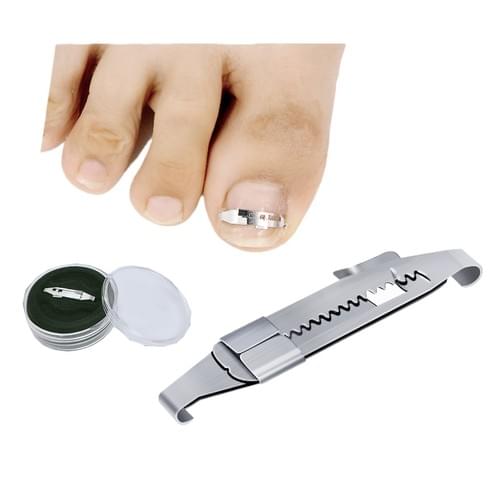 Ingrown Toenail Tools Kit