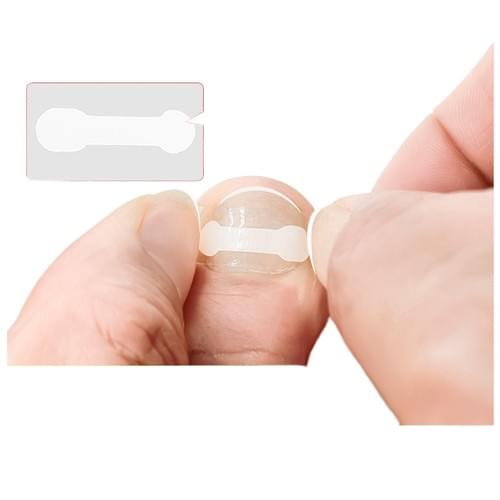 Toenail Strips Clear Toenail Patches Elastic Adhesive Patch Clips for Men Women Foot